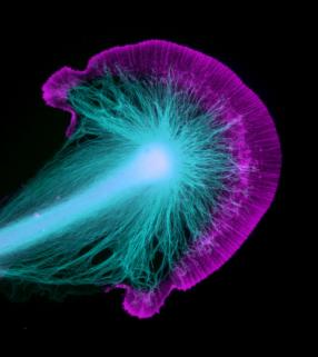 Actin filaments and Microtubules